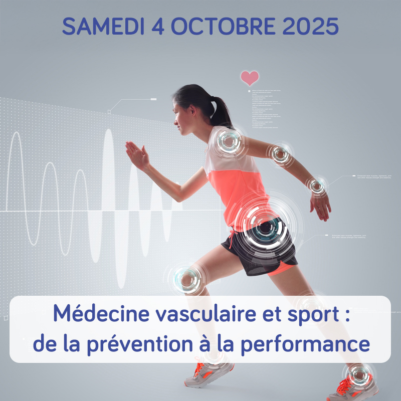 Médecine vasculaire et sport