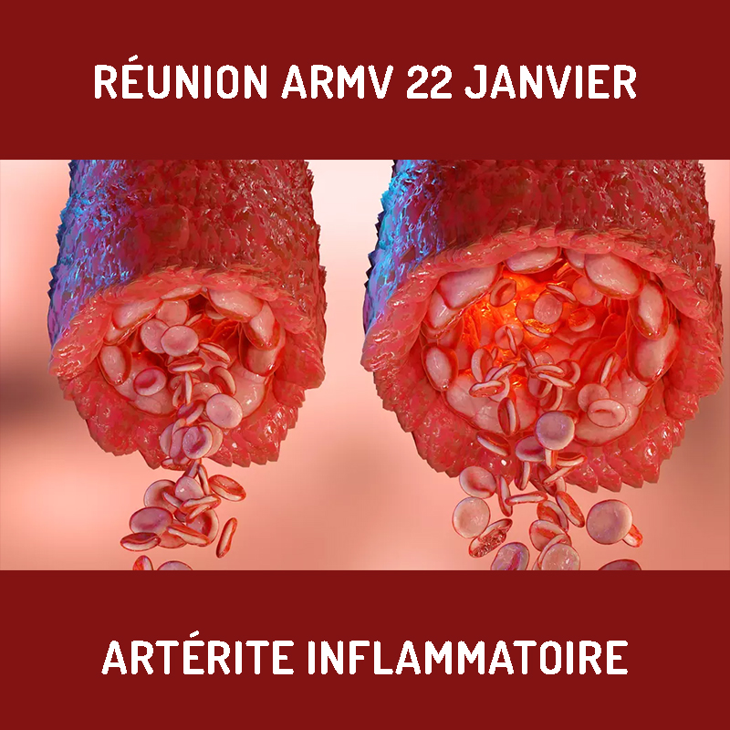 Réunion du 22 janvier